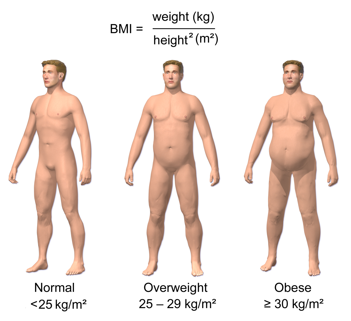 high bmi
